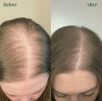 (BUY 1 GET 1 FREE) Kerarose® - Magic Rosemary Hair Growth Shampoo