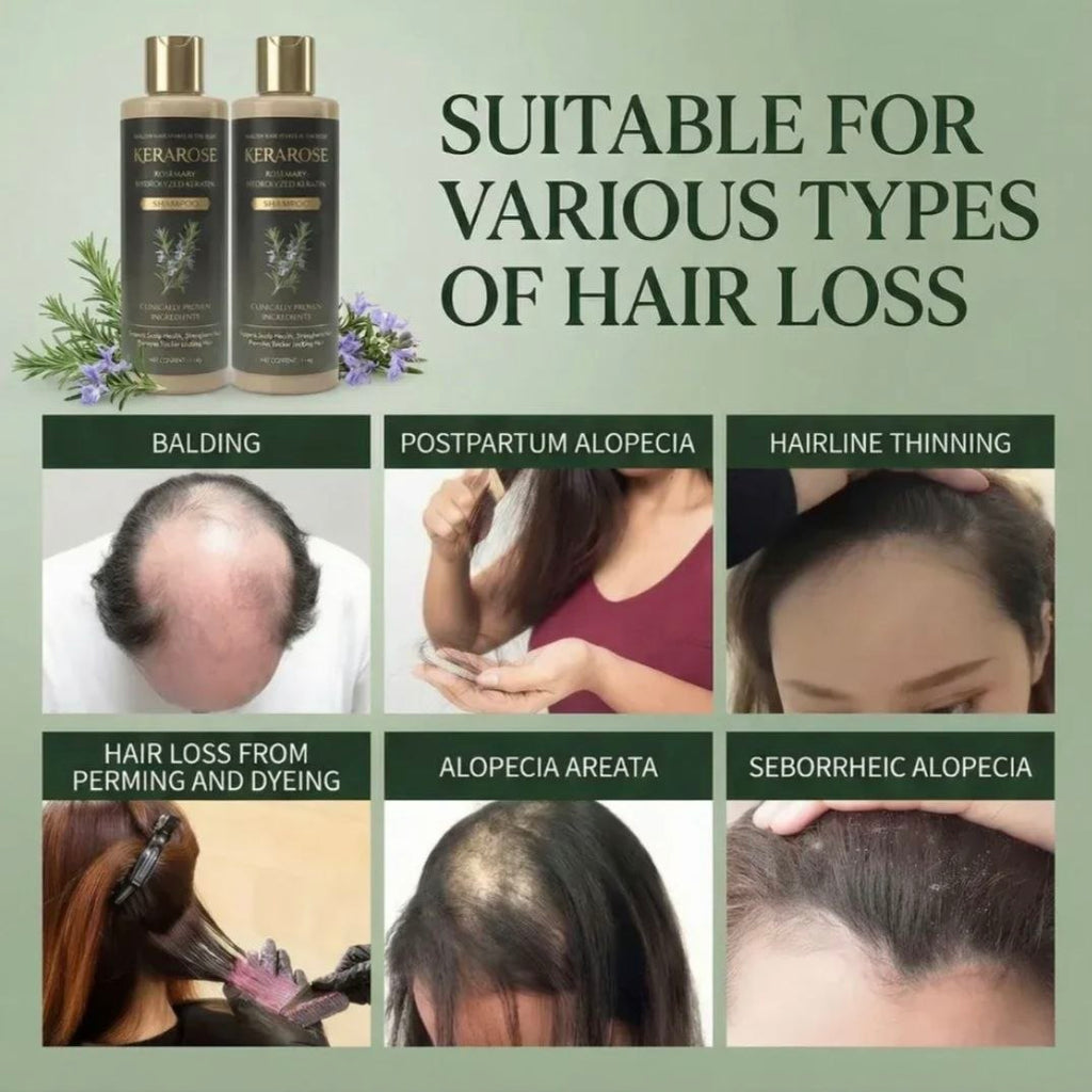 (BUY 1 GET 1 FREE) Kerarose® - Magic Rosemary Hair Growth Shampoo