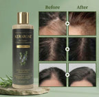 (BUY 1 GET 1 FREE) Kerarose® - Magic Rosemary Hair Growth Shampoo
