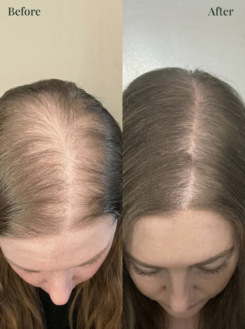 (BUY 1 GET 1 FREE) Kerarose® - Magic Rosemary Hair Growth Shampoo - social-proof-with-results
